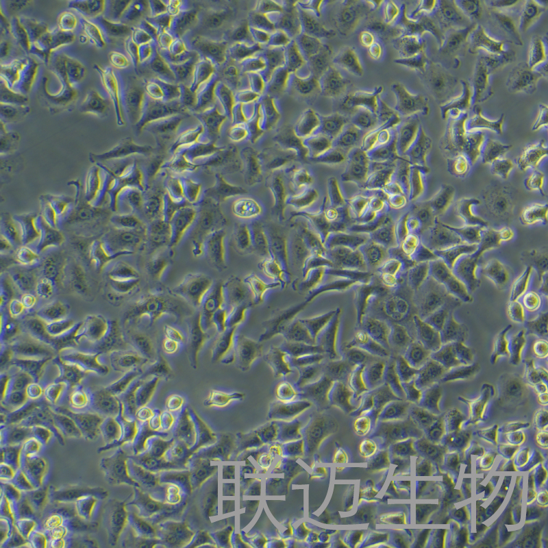 A549-GFP细胞（人肺癌细胞带绿色荧光）LM8C0016-G