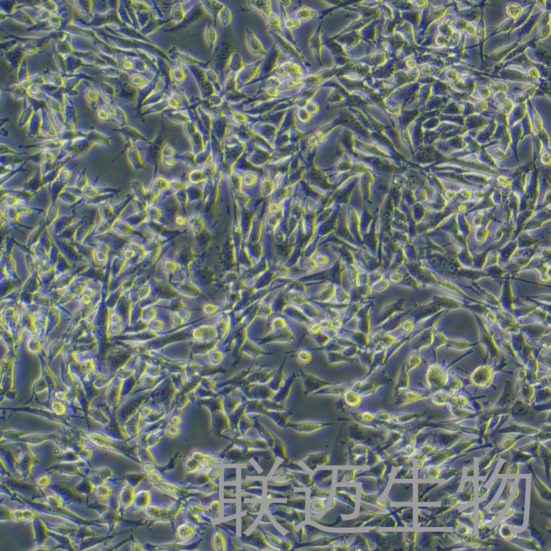 AKR细胞（小鼠食管癌细胞）LM8C1256