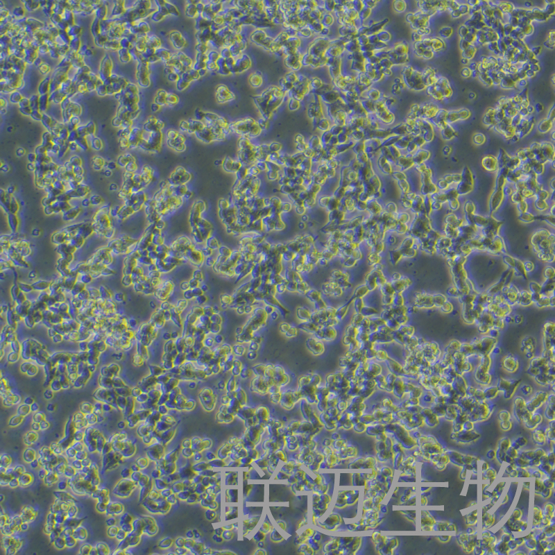 alphaTC1clone6细胞（小鼠胰岛素瘤胰岛a细胞）LM8C1257