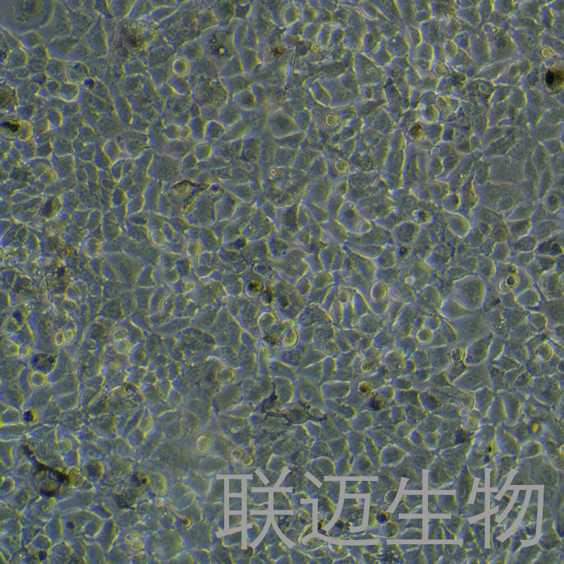 B16-F10/OVA细胞（小鼠黑色素瘤细胞）LM8C0319-OVA