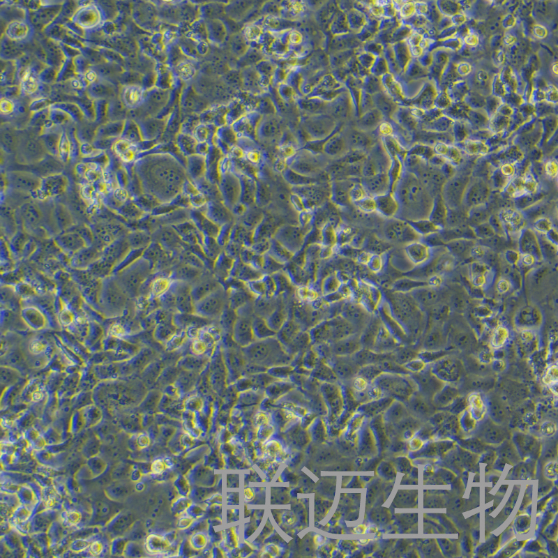 Bcpap-LUC细胞（人甲状腺癌乳头状细胞带荧光素酶）LM8C0575-L