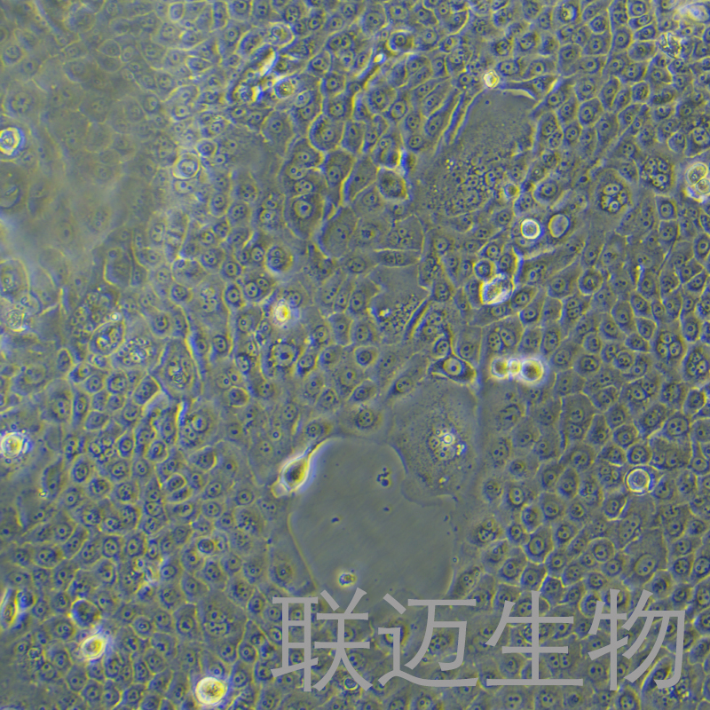 BxPC-3-LUC细胞（人原位胰腺腺癌细胞荧光素酶标记）LM8C0042-L