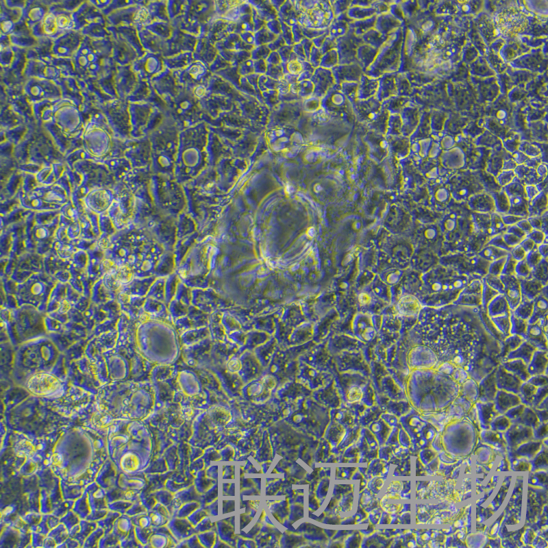 CACO-2-LUC-RFP细胞（人结直肠腺癌细胞红色荧光蛋白荧光素酶标记）LM8C0790-LR