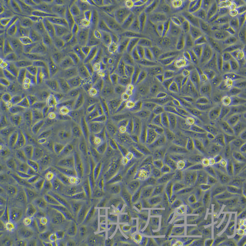 CADO-ES1细胞（人尤文氏肉瘤细胞）LM8C1272