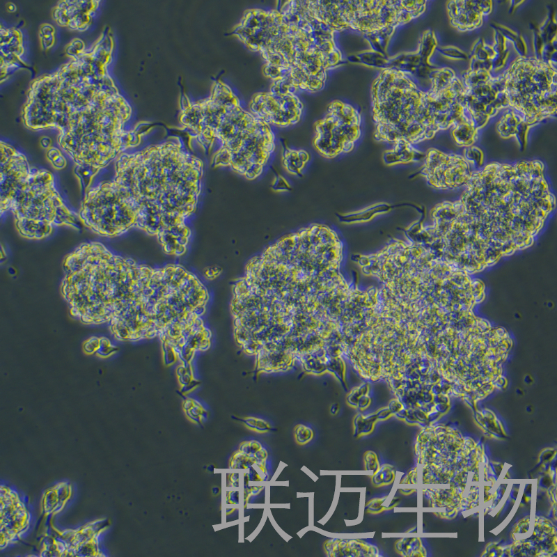 CAL-148细胞（人乳腺癌细胞）LM8C1273