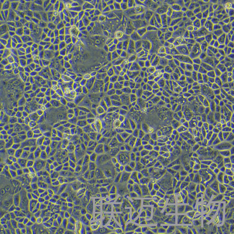 CAL51细胞（人乳腺癌细胞 （三阴性））LM8C1274