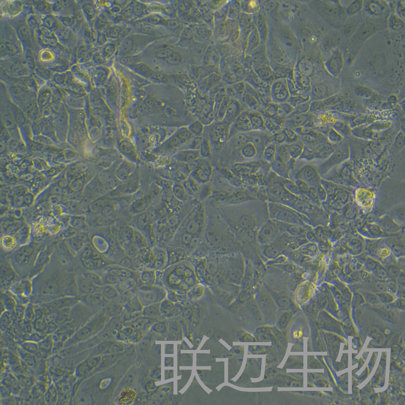 Capan-2-LUC细胞（人胰腺癌细胞荧光素酶标记）LM8C1166-L