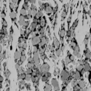 二铬化铝碳，Cr2AlC