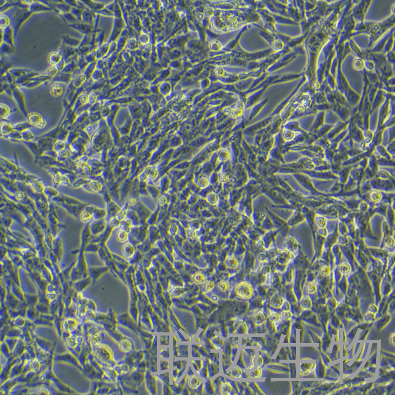 E0771-OVA-GFP细胞（小鼠乳腺癌细胞绿色荧光蛋白-OVA）LM8C0711-OVA-G