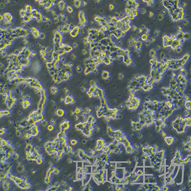 alphaTC1clone9细胞（小鼠胰腺癌细胞）LM8C1258