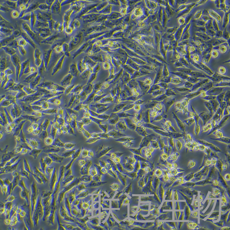 GIST-T1细胞（人胃肠道间质瘤细胞）LM8C1302