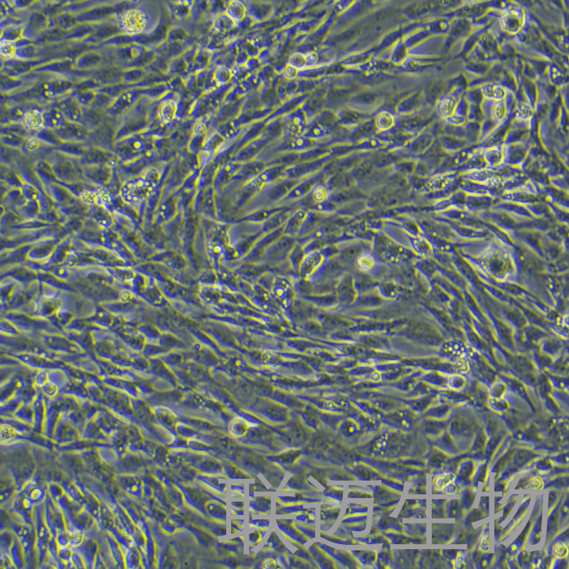 HDF-a细胞（人真皮成纤维母细胞-新生）LM8C1316