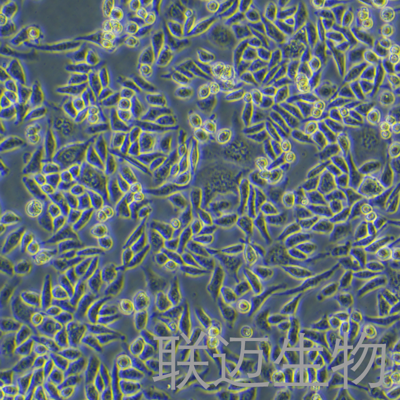 Hela-GFP细胞（人宫颈癌细胞带绿色荧光）LM8C0101-G