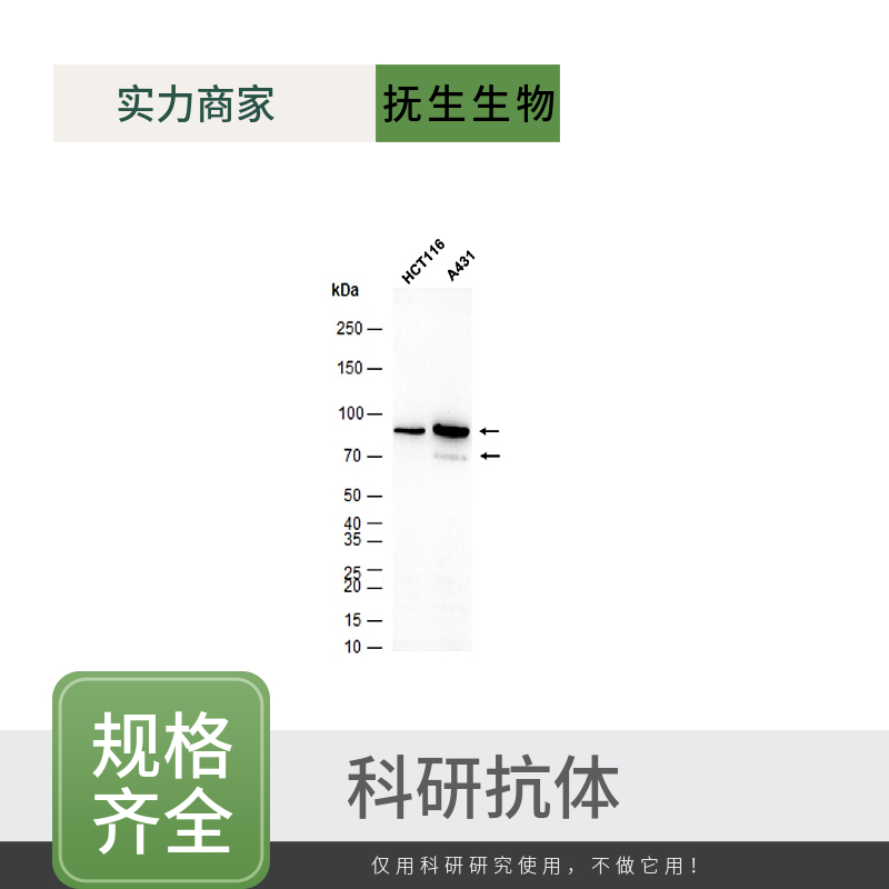 卷曲蛋白FZD7抗体
