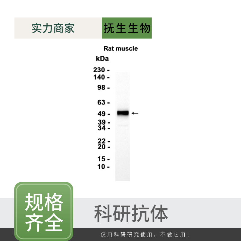淋巴细胞抗原6G抗体
