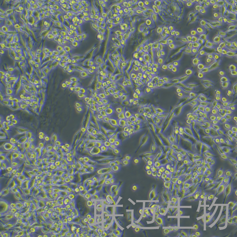 hep53.4细胞（小鼠肝癌细胞）LM8C1323