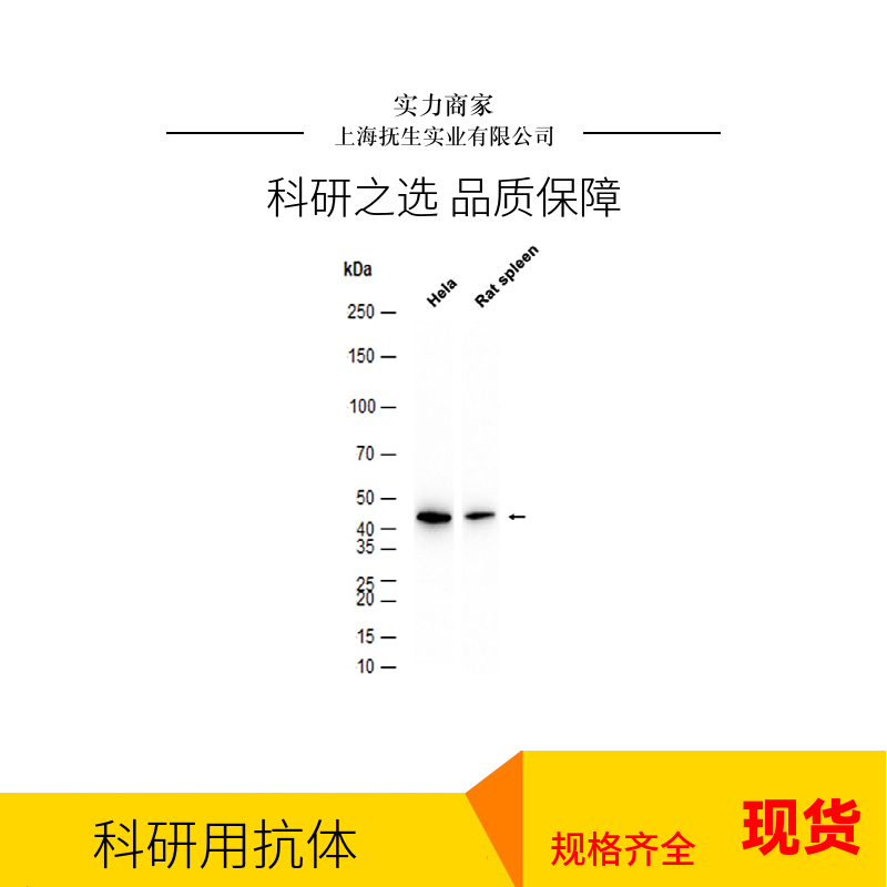 巨噬细胞清道夫受体抗体