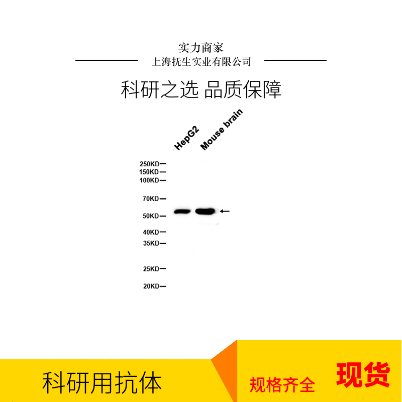 口蹄疫病毒O型VP1单克隆抗体