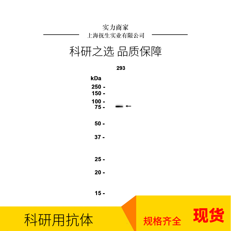 跨膜蛋白16A/钙激活氯离子通道抗体
