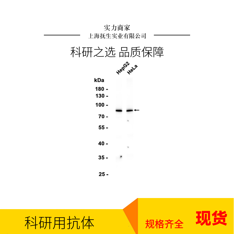跨膜蛋白173抗体