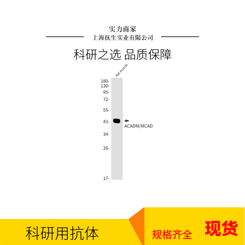 腱调蛋白/软骨调节素样1蛋白抗体