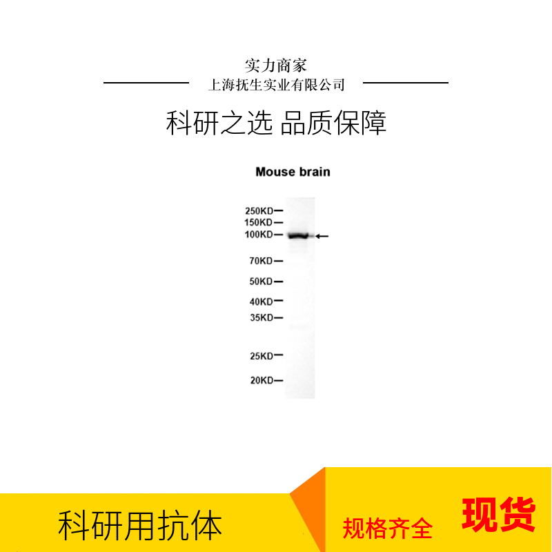 胶质细胞源性神经营养因子抗体