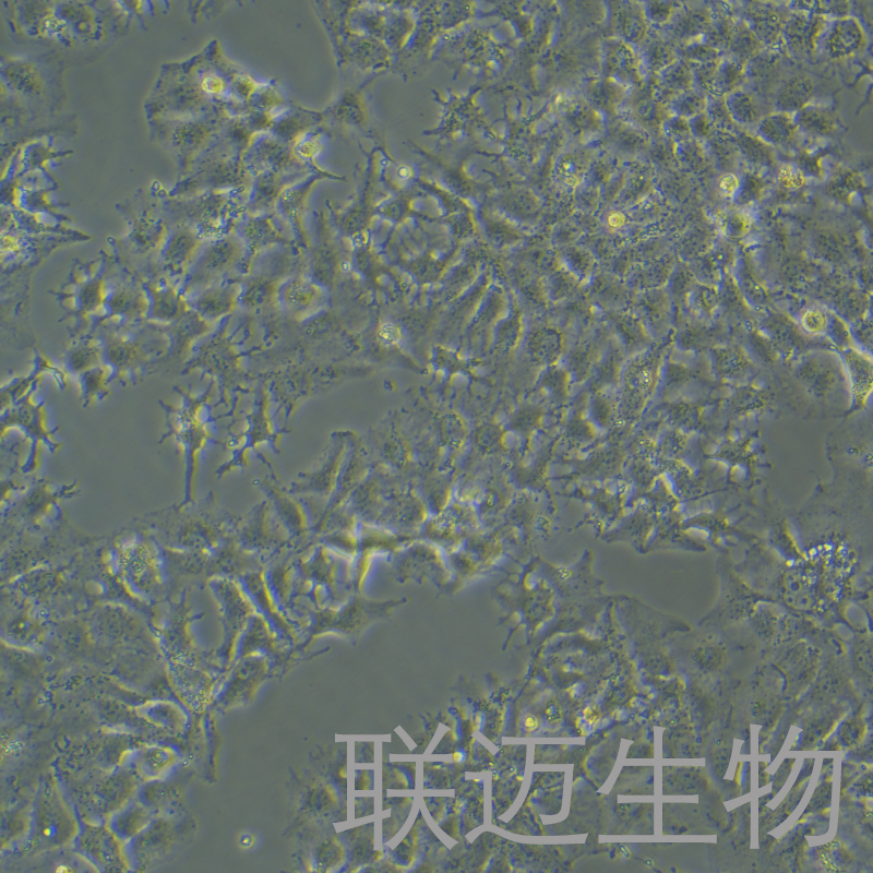 HUH7/Lenvatinib细胞（人肝癌乐伐替尼耐药株）LM8C0120D2