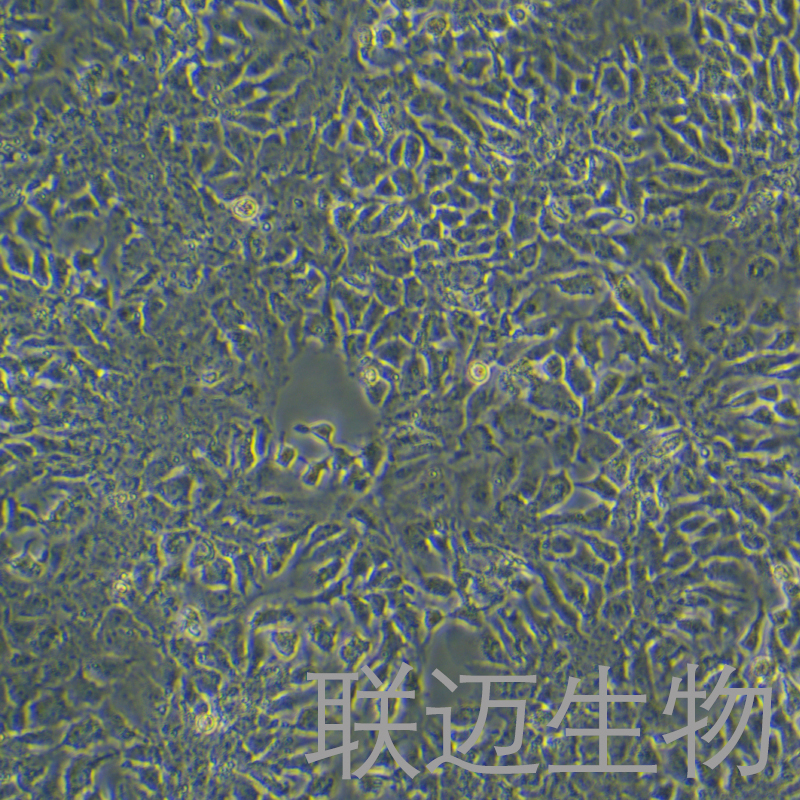 Huh-7/sorafenib细胞（人肝癌索拉非尼耐药株）LM8C0120D