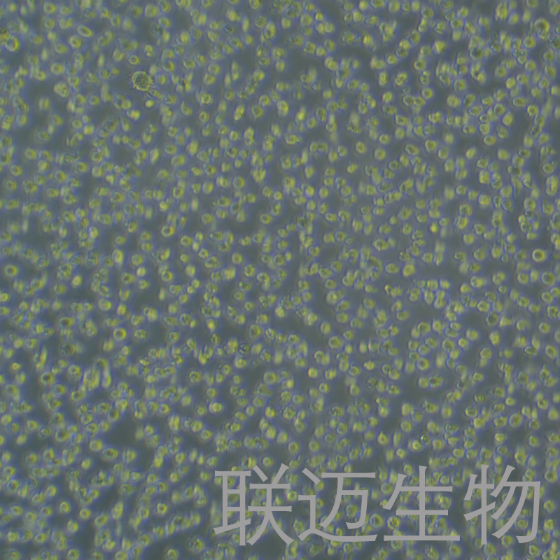 Jurkat-LUC细胞（人急性T淋巴细胞白血病细胞带荧光素酶）LM8C1346-L