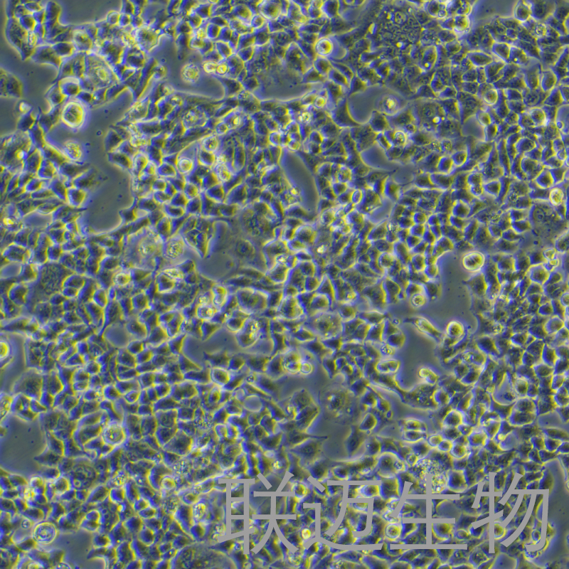 KYSE-70细胞（人食道麟癌细胞）LM8C1357