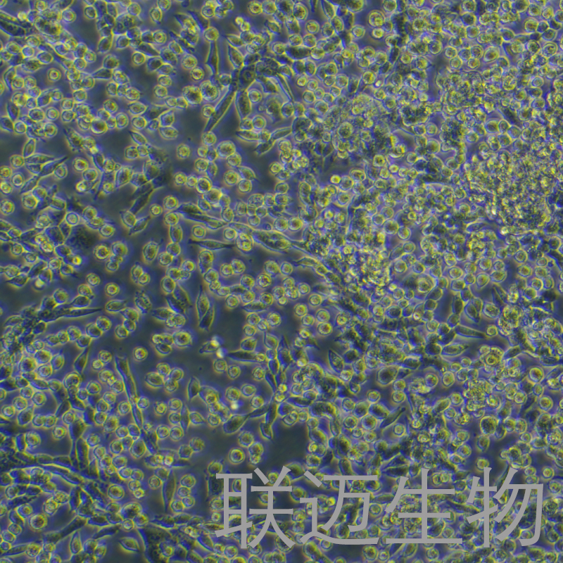 LLC-GFP细胞（小鼠肺癌细胞带绿色荧光）LM8C0140-G