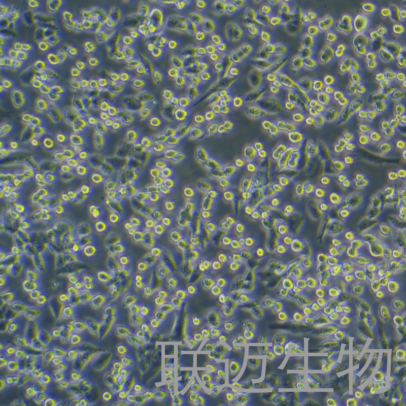 LLC-OVA细胞（小鼠肺癌细胞）LM8C0140-OVA