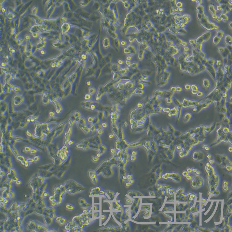 LLC-OVA-LUC细胞（小鼠肺癌细胞荧光素酶标记-OVA）LM8C0140-OVA-L