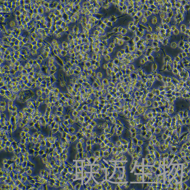 MADB106-LUC细胞（大鼠乳腺癌细胞荧光素酶标记）LM8C0148-L