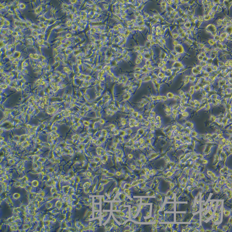 MB49-LUC细胞（小鼠膀胱癌细胞带荧光素酶）LM8C0950-L