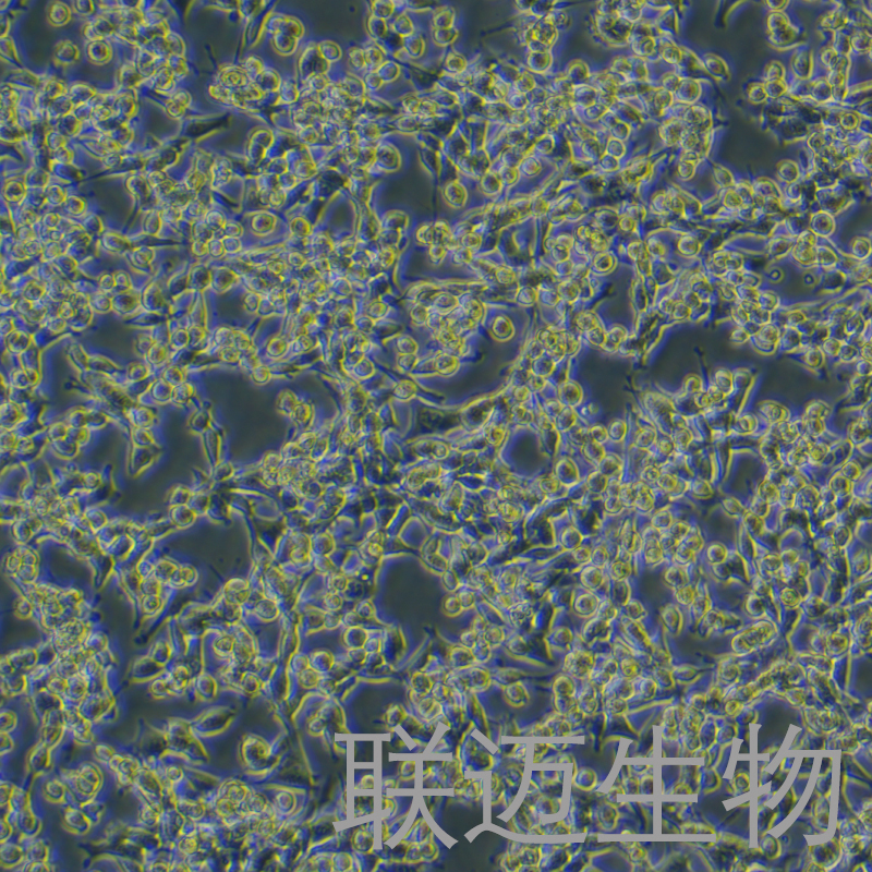 MBT-2-Luc细胞（小鼠膀胱癌细胞荧光素酶标记）LM8C0939-L