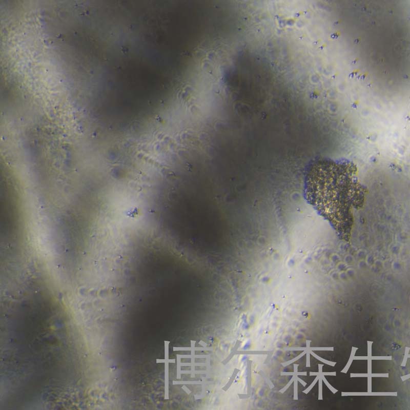 ECC12细胞（人胃癌细胞）