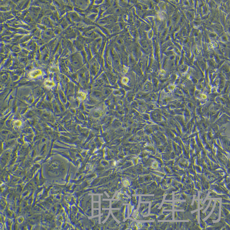 MDA-MB-231/DDP-GFP细胞（人乳腺癌顺铂耐药株+绿色荧光蛋白）LM8C0150D-G