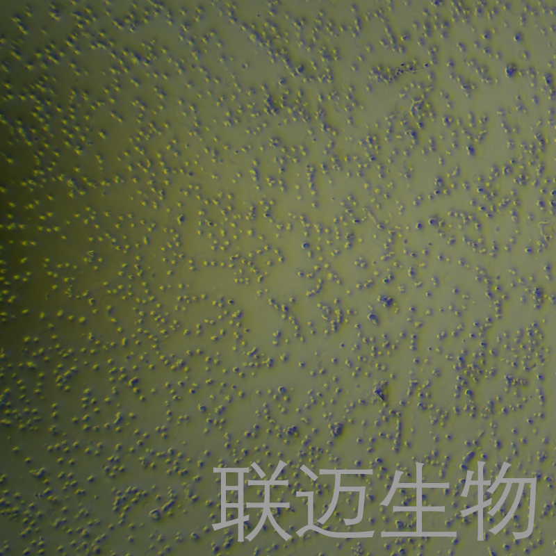 NALM-6-LUC细胞（人B淋巴白血病细胞荧光素酶标记）LM8C0906-L