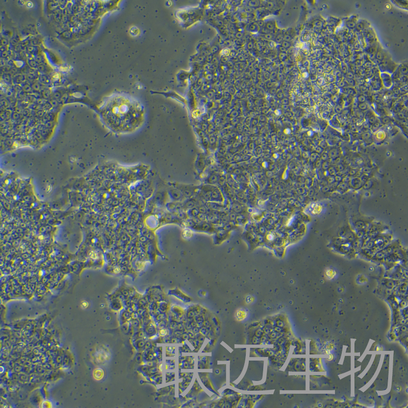 NCI-H1435细胞（人肺腺癌细胞）LM8C1391