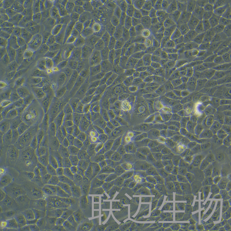 NPC/HK-1细胞（人鼻咽癌细胞）LM8C1406