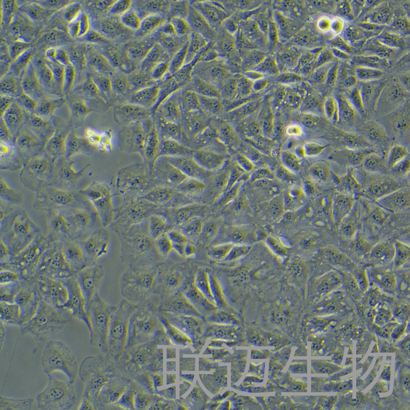 OAW42细胞（人卵巢癌细胞）LM8C1408