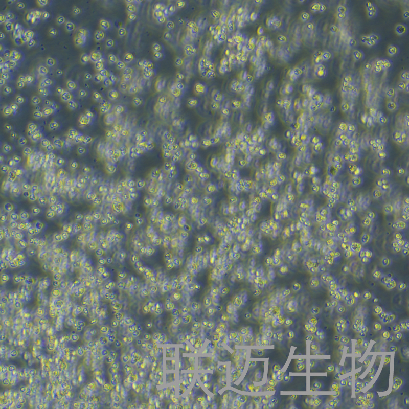 OCI-LY10细胞（人弥漫大B细胞淋巴瘤细胞）LM8C1409