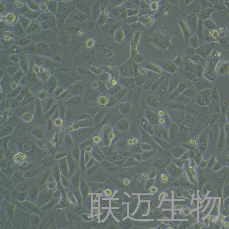 OV56细胞（人浆液性卵巢腺癌细胞）LM8C1412