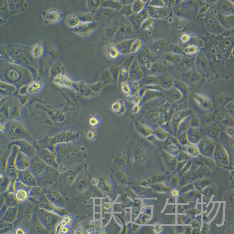 OVISE细胞（人卵巢癌细胞）LM8C1413