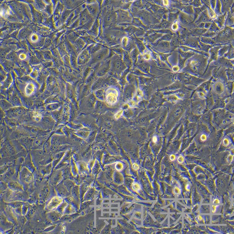 CAL-120细胞（人乳腺癌细胞）