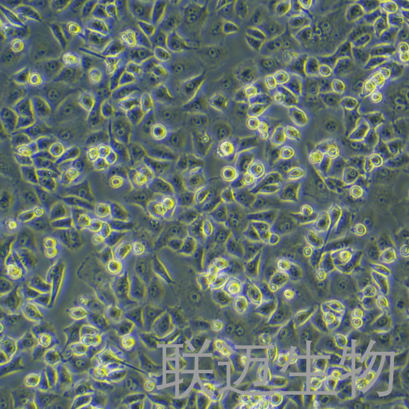 PANC-1-LUC-eGFP-Puro细胞（人胰腺癌细胞绿色荧光蛋白荧光素酶标记）LM8C0184-LG