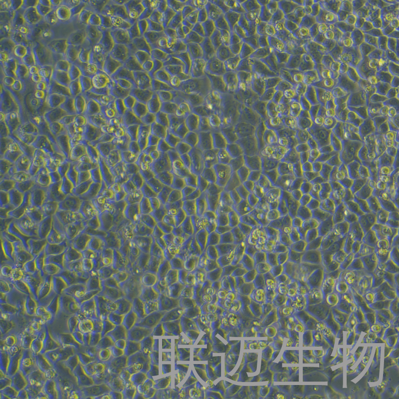 PC-9-Luc-GFP细胞（人肺癌细胞荧光素酶标记 +绿色荧光蛋白）LM8C0671-LG