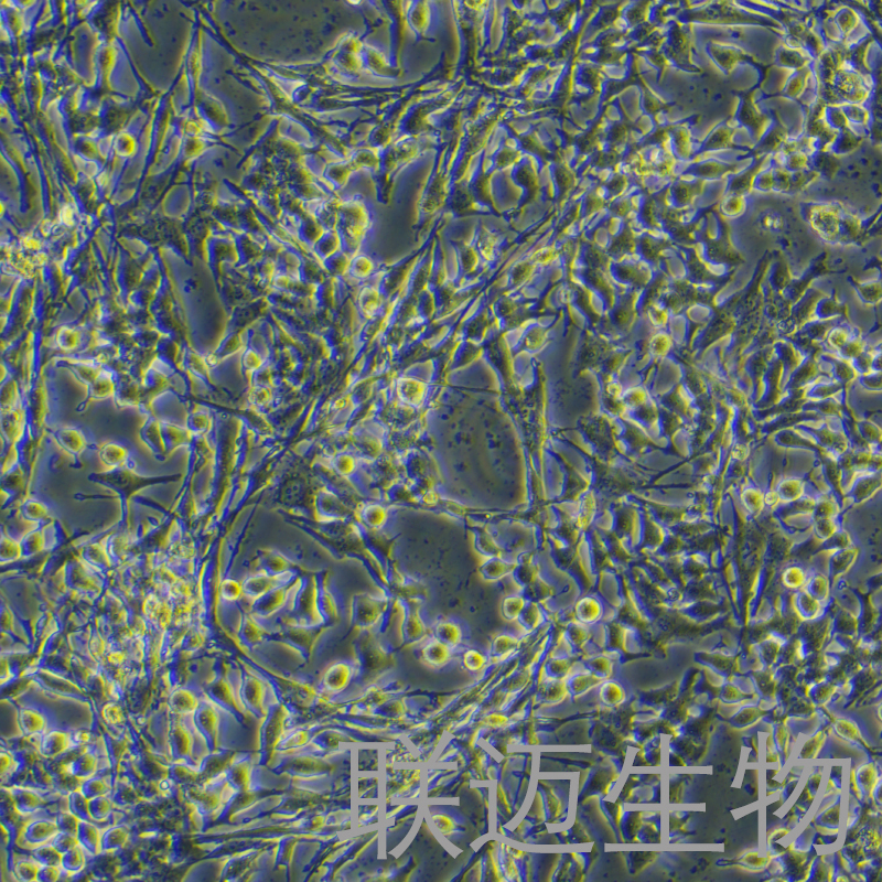 PIG1细胞（正常人皮肤黑色素细胞）LM8C1417