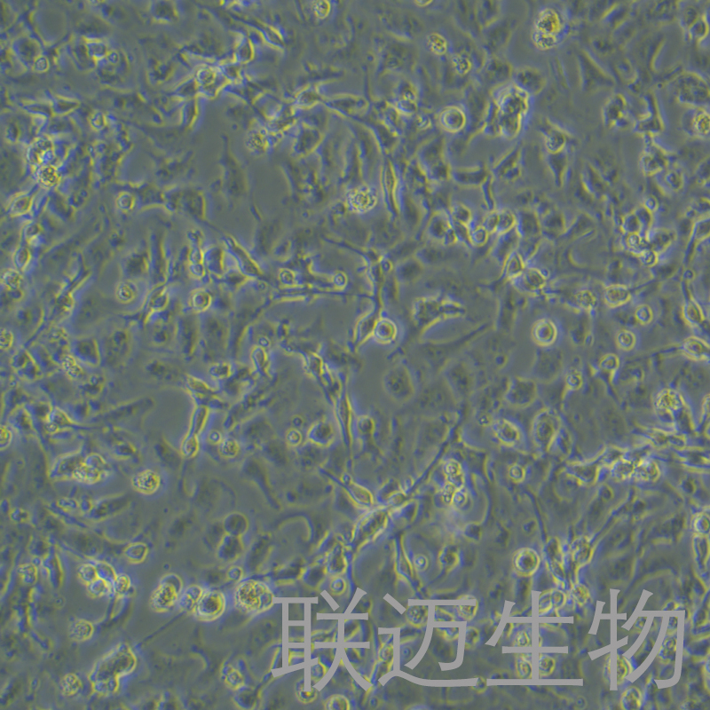 RD-ES细胞（人尤文氏肉瘤）LM8C1422